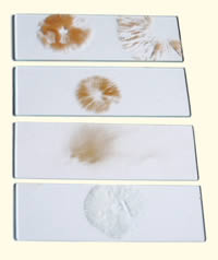 Quelques exemples de sporulations de divers champignons.