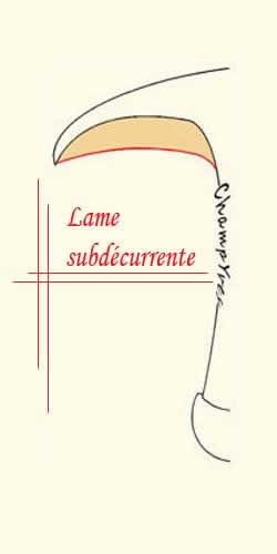 Champignon Ã  lame sub-dÃ©currente.